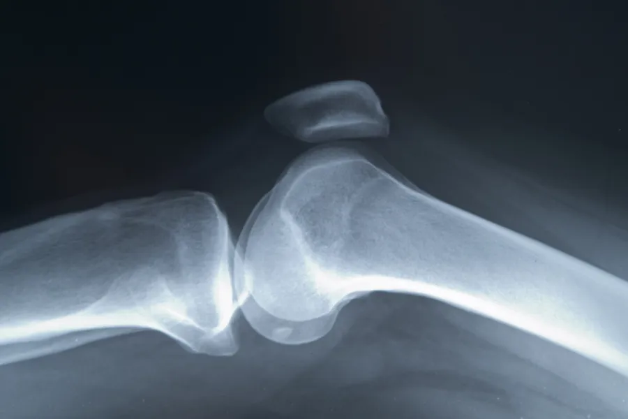 Et nærbilde av månen